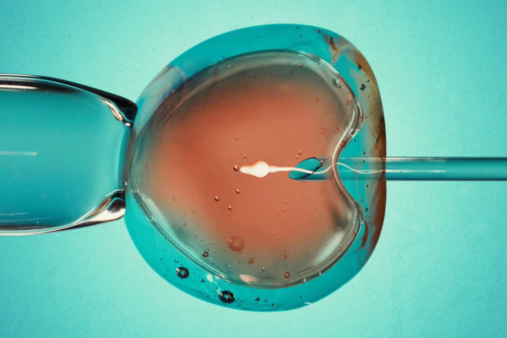 Microscope view of in vitro fertilization