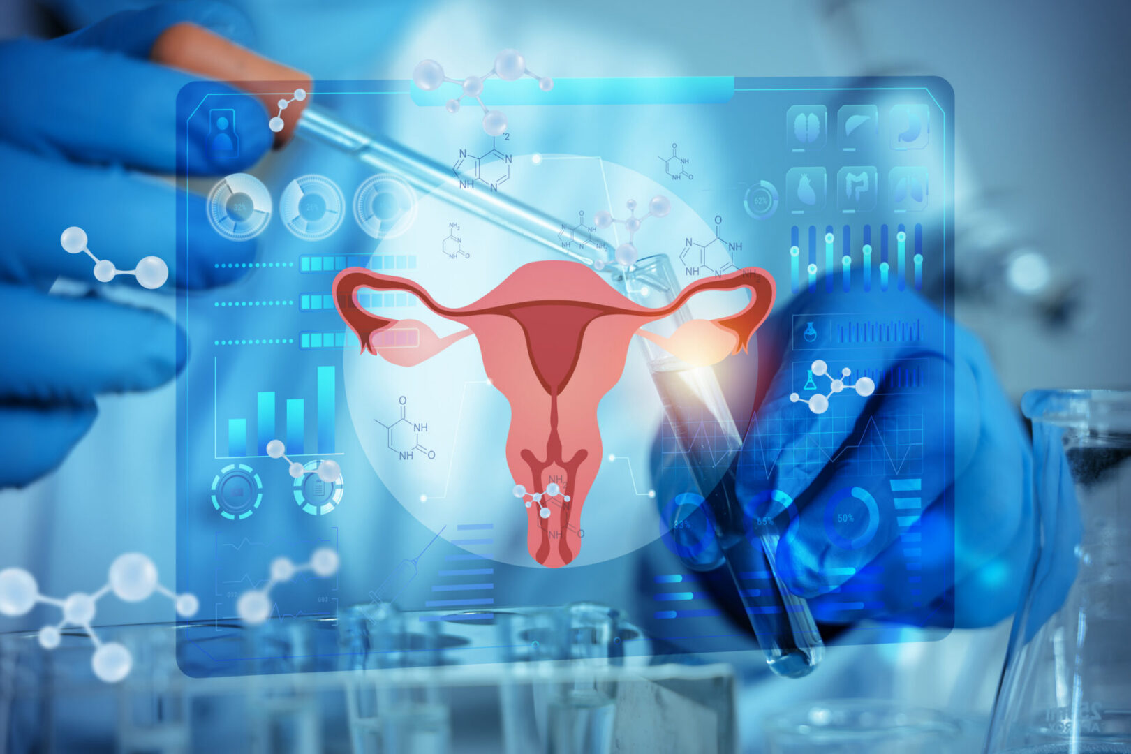 Medical analysis with uterus graphics