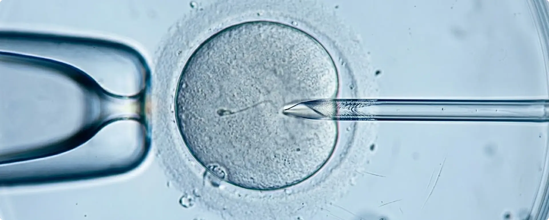 Ivf